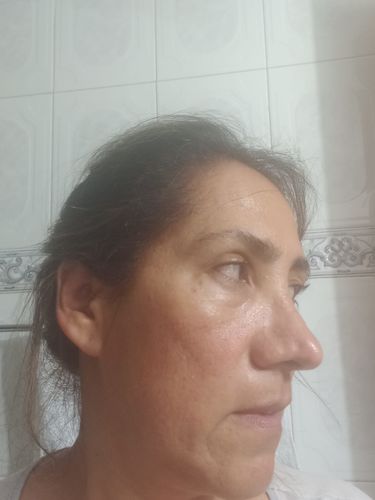 Customer photo review of HYDRO BOOSTER CREMA FACIAL CON 48 HORAS DE HIDRATACIÓN