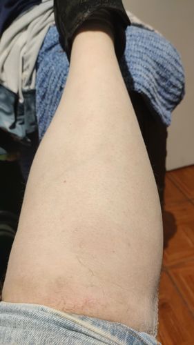 Customer photo review of Depilador Nuva Skin®