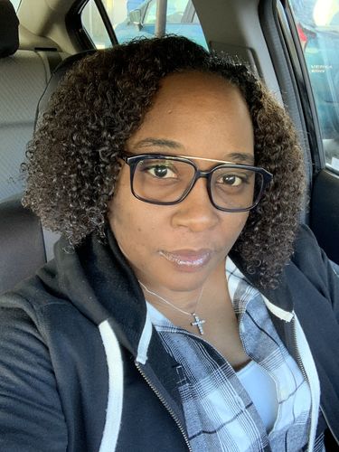 Customer photo review of BERRI-CLEAR+ 5 BERRY SUPERFRUIT SERUM