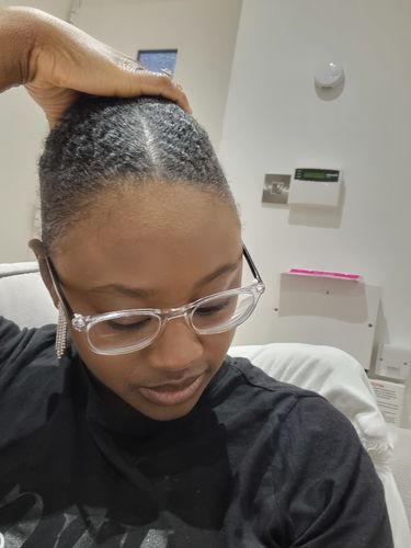 Customer photo review of Grow Pro: Derma Roller for Hair & Beard