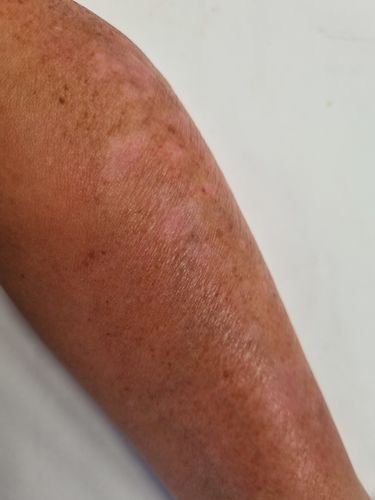 Customer photo review of Multi Strain Biotic
