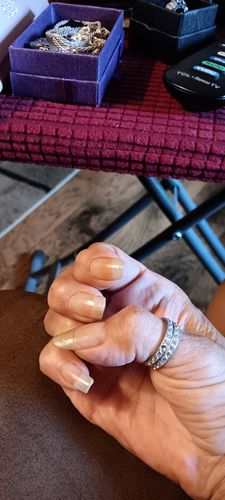 Customer photo review of The Nail Starter Kit