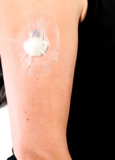 Customer photo review of Skin Grip Original - Dexcom G7 Adhesive Patches (With Hole)
