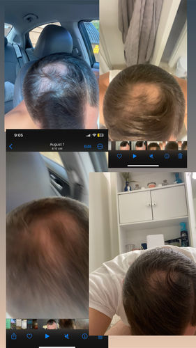 Customer photo review of Root Activator Shampoo