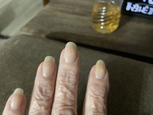 Customer photo review of Conceal & Repair Kit