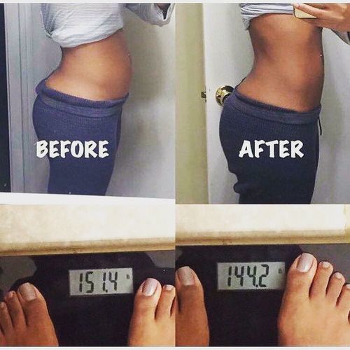 Customer photo review of DermaLux™ Perfektes Detox Schlankheitspflaster