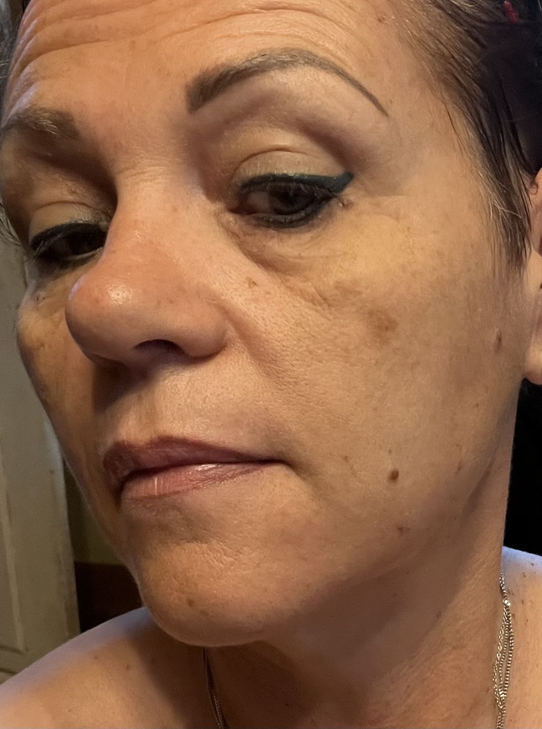 Customer photo review of Acide Hyaluronique - 1 mois