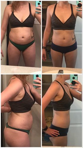 Customer photo review of DermaLux™ Perfektes Detox Schlankheitspflaster