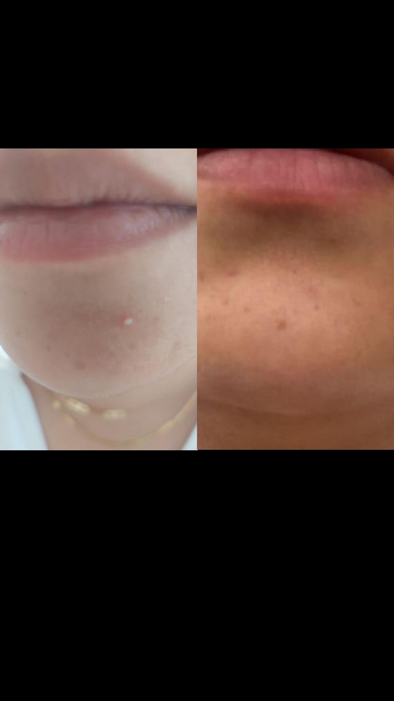 Customer photo review of HaloSkin Day & Night Patches