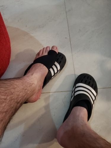 Customer photo review of Bunion Corrector - Toe Separator and Corrector