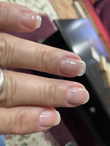 Customer photo review of The Nail Starter Kit