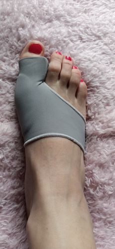 Customer photo review of Bunion Corrector - Toe Separator and Corrector