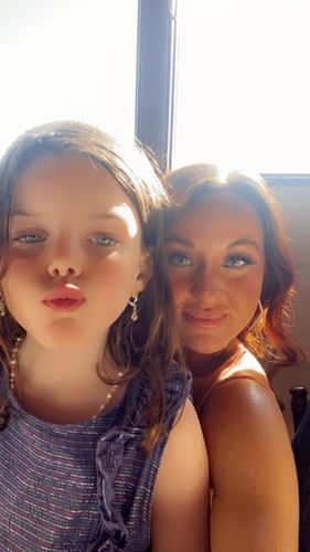 Customer photo review of Meetone Pro Blue Contact Lenses