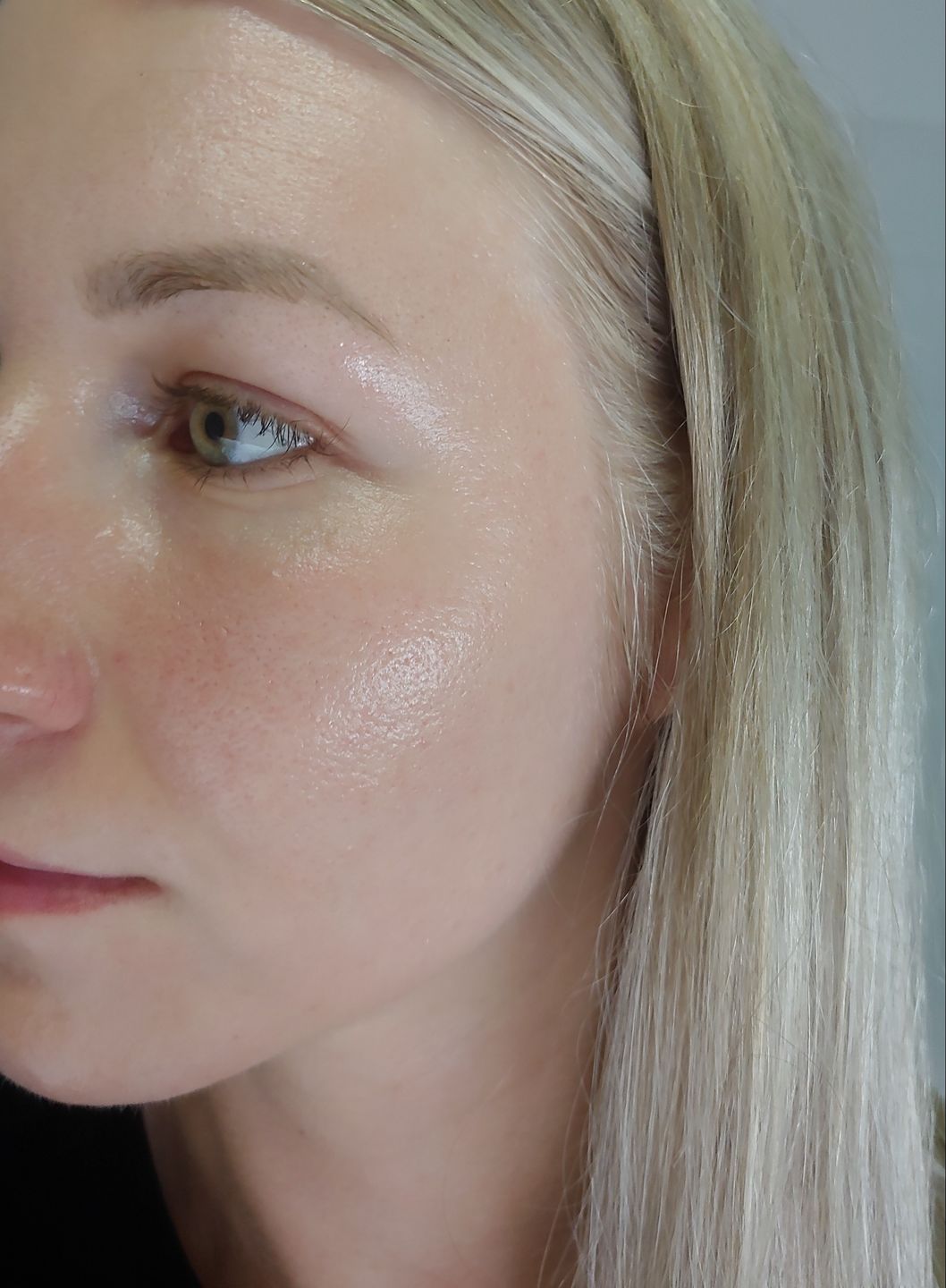 Customer photo review of Microbiom Schutzschicht