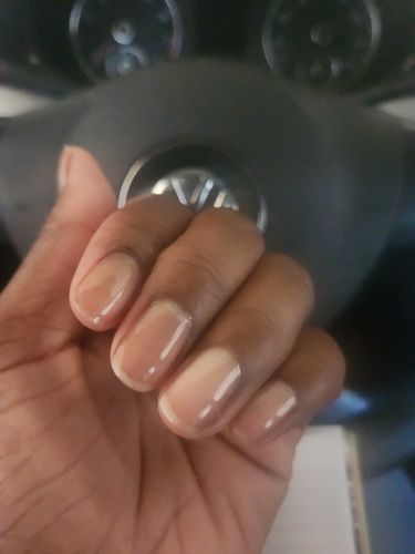 Customer photo review of The Nail System