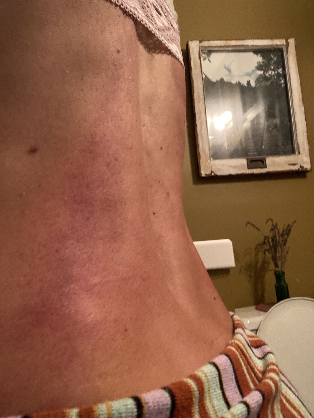 Customer photo review of Muscle Melt Balm
