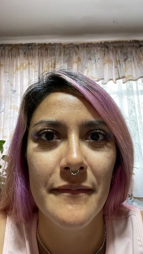 Customer photo review of Dermolimpiador acne control