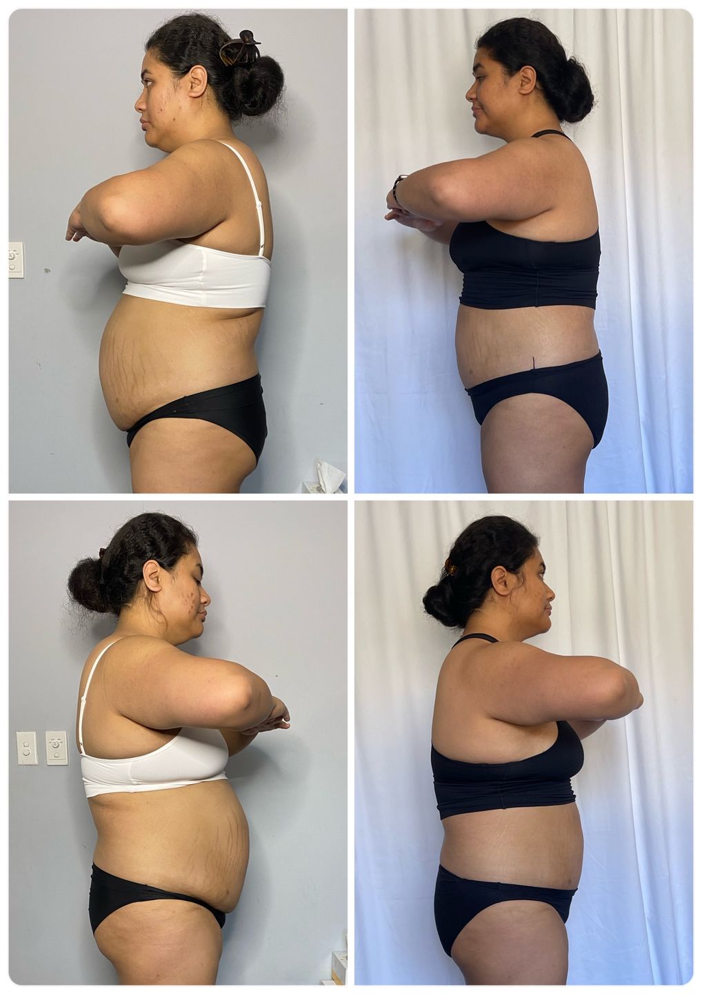 Customer photo review of 14 Day Detox Tea + FREE SHIPPING $110+
