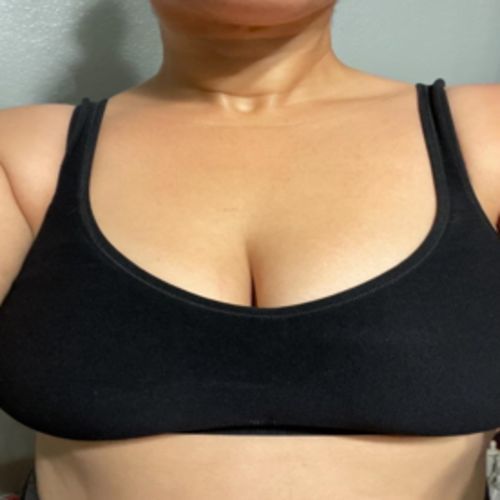 Customer photo review of Glammering® Premium Wireless Shaper Bra