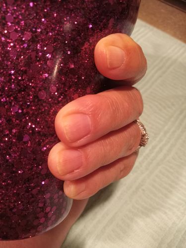 Customer photo review of The Nail System