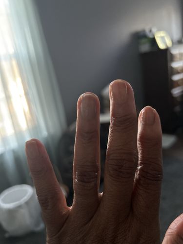 Customer photo review of Route Package Protection