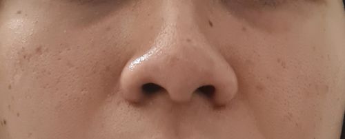 Customer photo review of Dark Scar Mini Kit