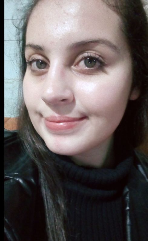 Customer photo review of Hyaluronic Acid 2% + B5 Hydrating Serum