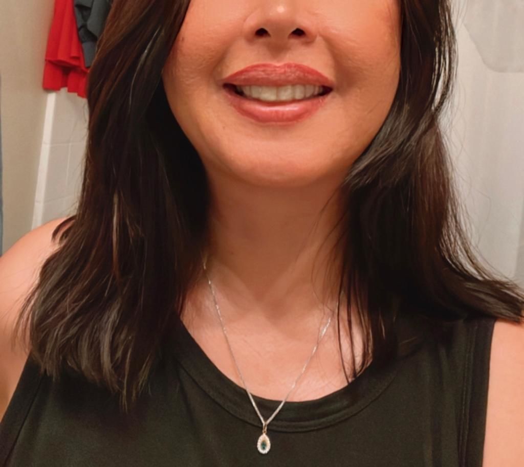 Customer photo review of 3mm Ultra Hard Night Guard for Severe Teeth Grinding/Clenching- Maximum Protection while you Sleep