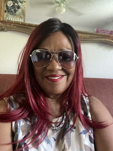 Customer photo review of Nadinola Skin Cream For Normal Skin, 2.25 Oz.