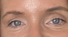 Customer photo review of Purely Lashes Lash Growth Serum