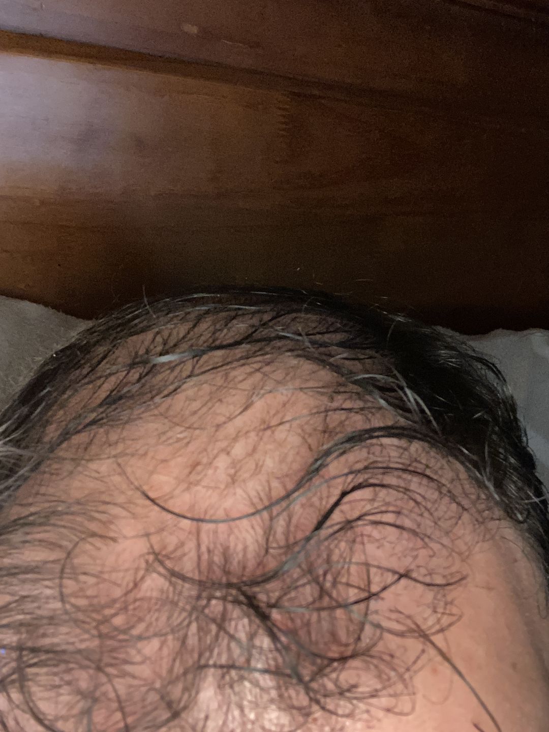 Customer photo review of Tratamiento anticaída 1 mes + Biotina