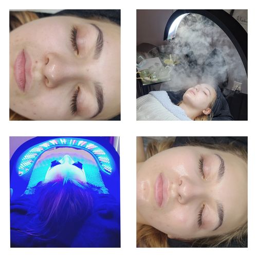 Customer photo review of The CosmoGlo XL Light Bundle + Phone Clip