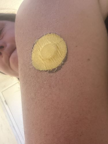 Customer photo review of Skin Grip Original - Freestyle Libre 3 Adhesive Patches