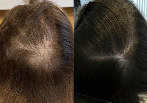 Customer photo review of ARREMI HAARÖL