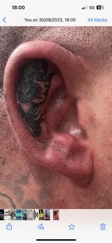 Customer photo review of TattooNumbx Numbing Cream