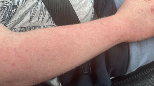 Customer photo review of Multi Strain Biotic