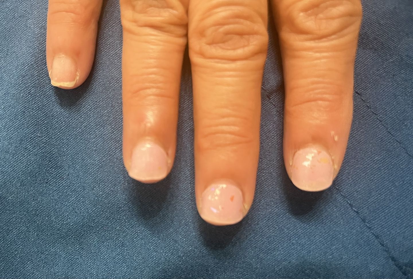 Customer photo review of Pink Bunny Speckles DIY Semicured Gel Nail Sticker Kit (PRE-ORDER: ETA 24.7)