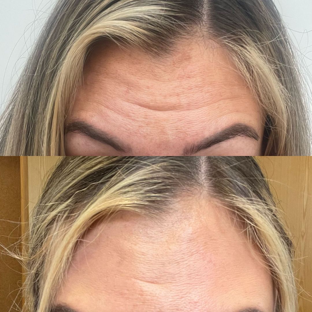 Customer photo review of Your Beauty Daily Collagen Powder