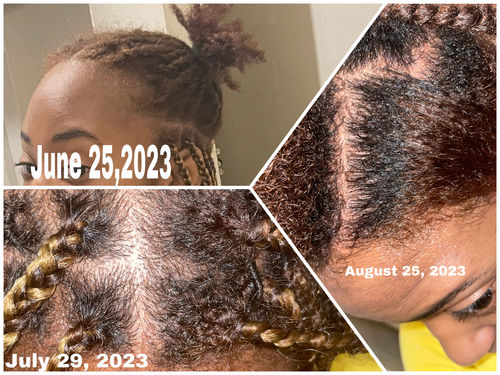 Customer photo review of Rice Water Scalp Mist (PreMade)