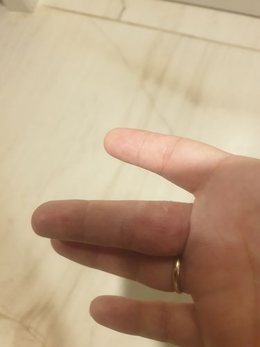 Customer photo review of קרם לחות טיפולי לעור יבש עד יבש במיוחד | TOPIC FACE & BODY CREAM