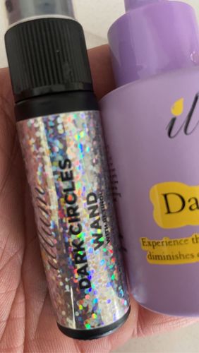 Customer photo review of Dark Circles Treatment