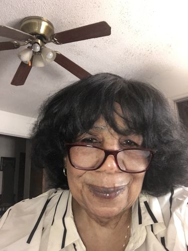 Customer photo review of Omic LightenUp Anti-Aging Lightening Cream - 100ml