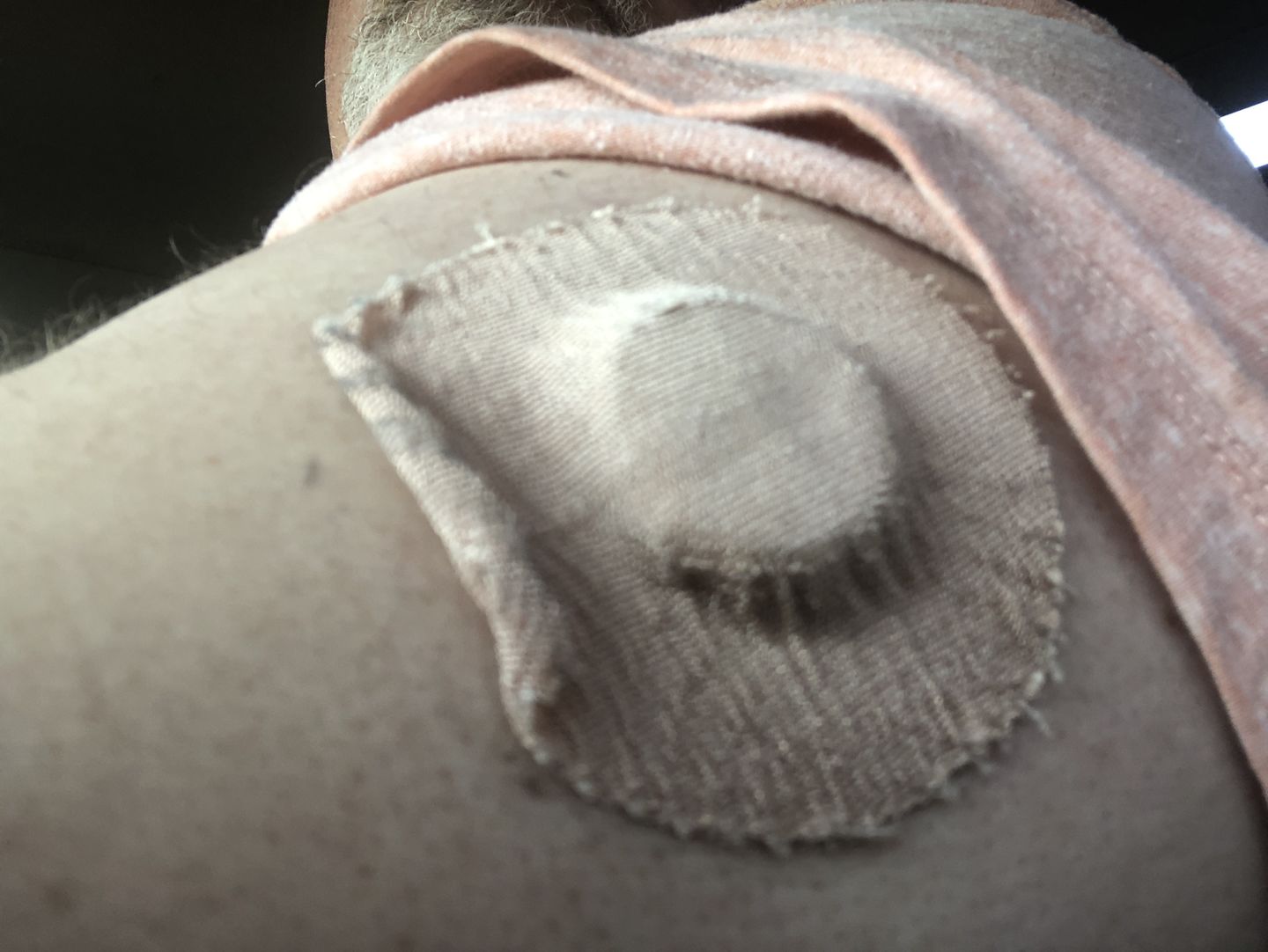 Customer photo review of Skin Grip Original - Freestyle Libre Adhesive Patches