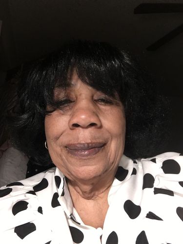 Customer photo review of Omic LightenUp PLUS Active Lightening Cream - 100ml / 3.4 Oz