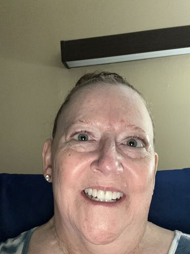 Customer photo review of Tri Pulse™ Refill Kit