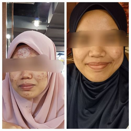 Customer photo review of Brightening Face Creme