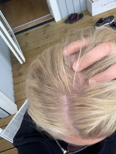 Customer photo review of LA Sunkissed Touch Up Color