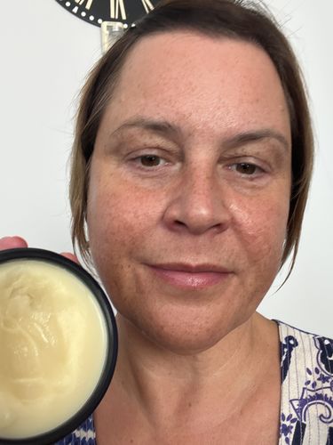 Customer photo review of Instant Hydration Body Balm