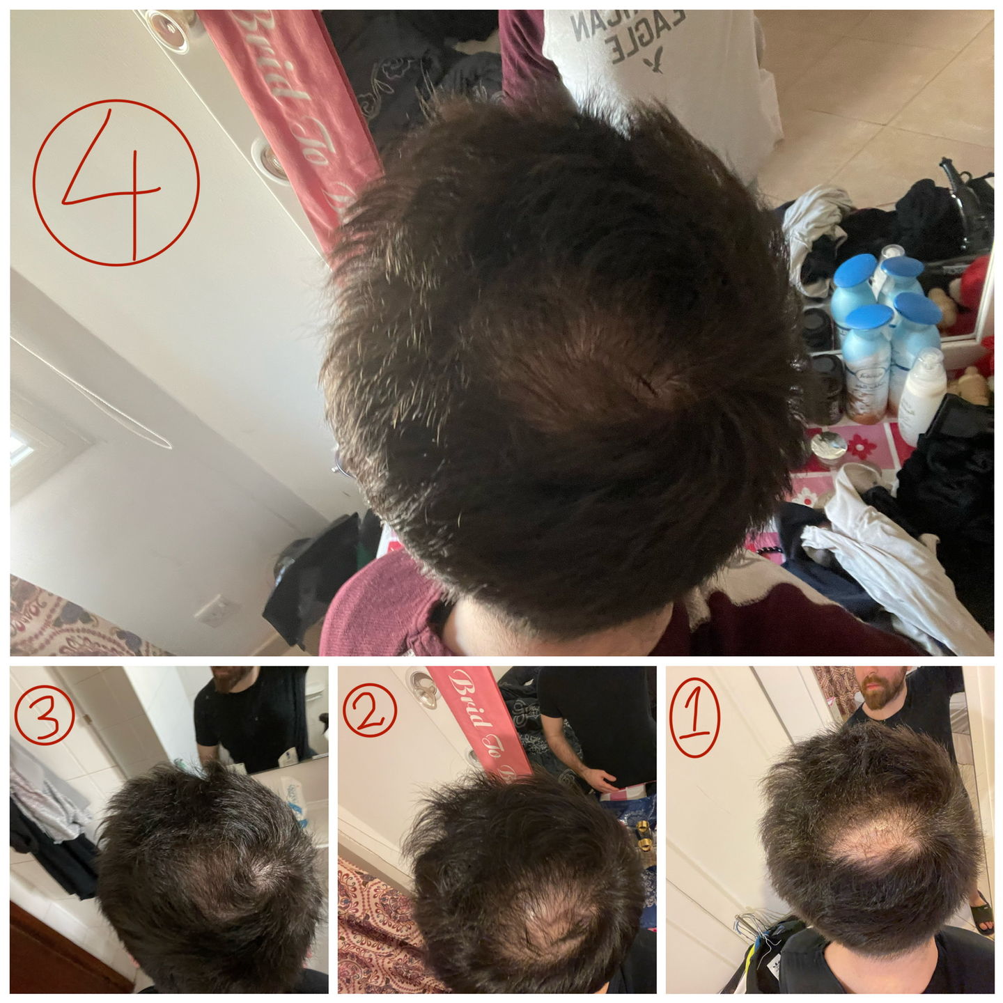 Customer photo review of Good Hair Men Anti-chute homme - 3 mois