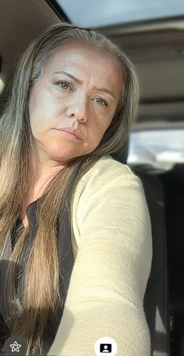 Customer photo review of HYDRO BOOSTER CREMA FACIAL CON 48 HORAS DE HIDRATACIÓN